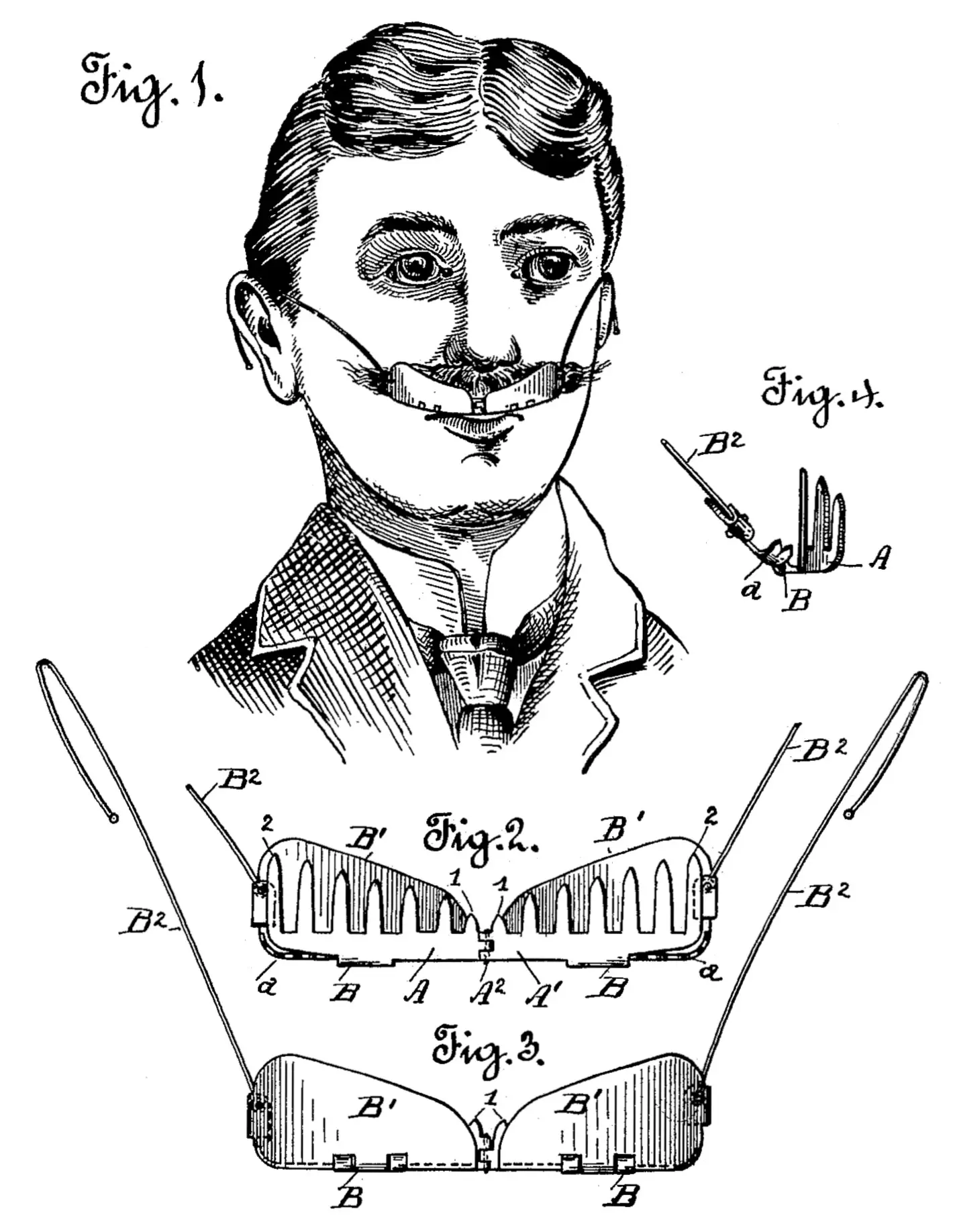 parts
